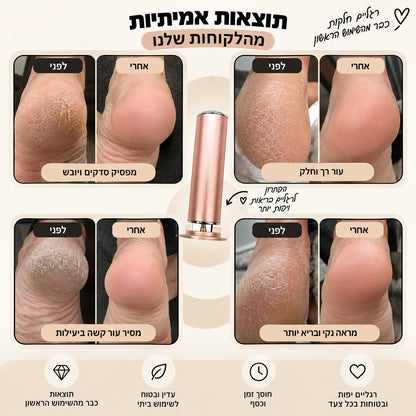 מארז הפדיקור של Handora