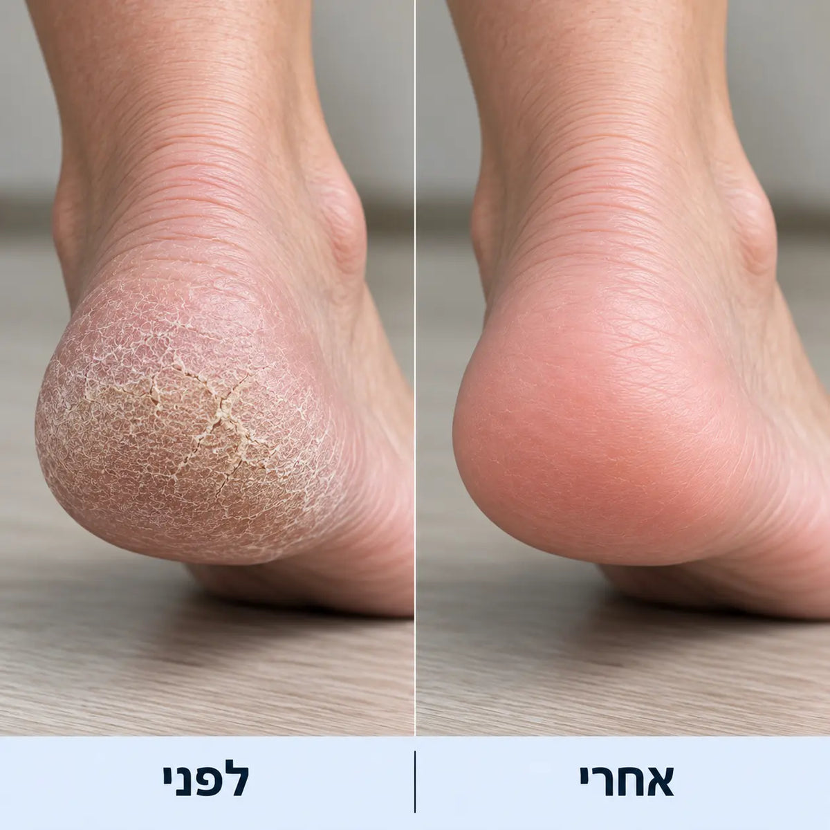 מארז הפדיקור של Handora