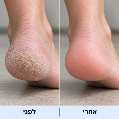 מארז הפדיקור של Handora